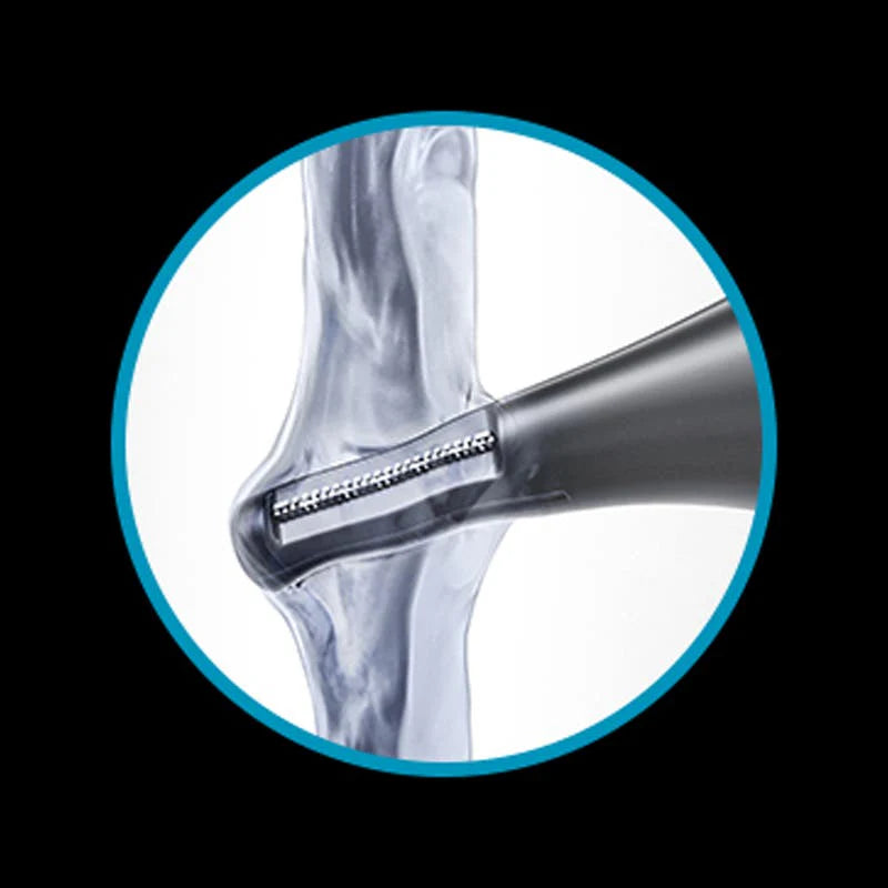 Wahl Precision Ear &amp; Nose Battery Trimmer
